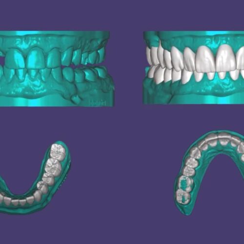 Odontologia Digital Alexandre Cesar