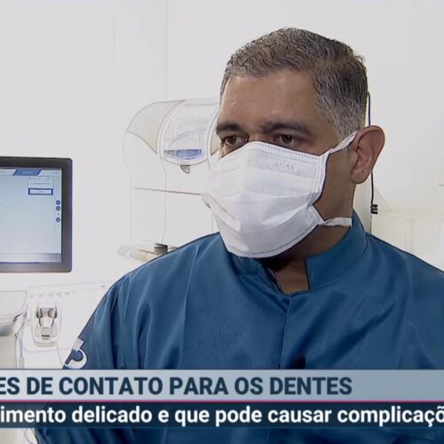 Dr. Alexandre Cesar fala sobre lentes de contato dentárias no SBT