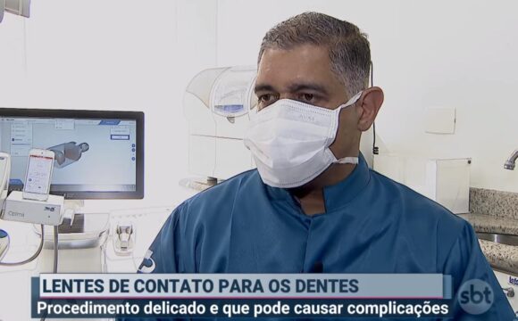 Dr. Alexandre Cesar fala sobre lentes de contato dentárias no SBT