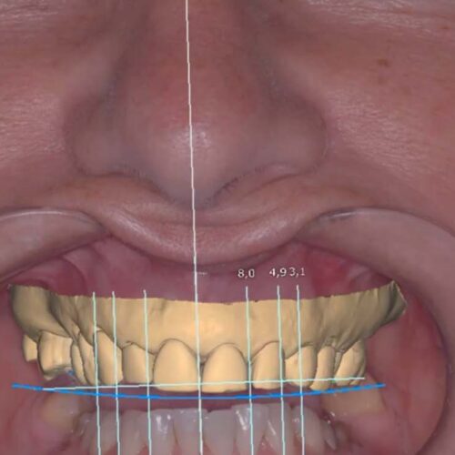 Como fazer um mockup do seu sorriso