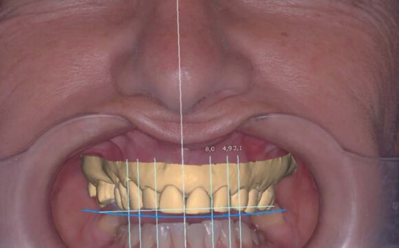 Como fazer um mockup do seu sorriso