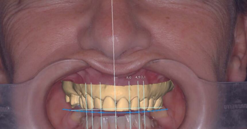 Como fazer um mockup do seu sorriso